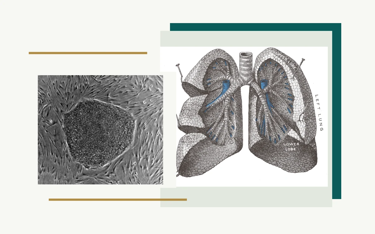Historical anatomical illustration: lungs with branching bronchi and bronchioles · Microscopy of an embryonic stem-cell colony on feeder cells