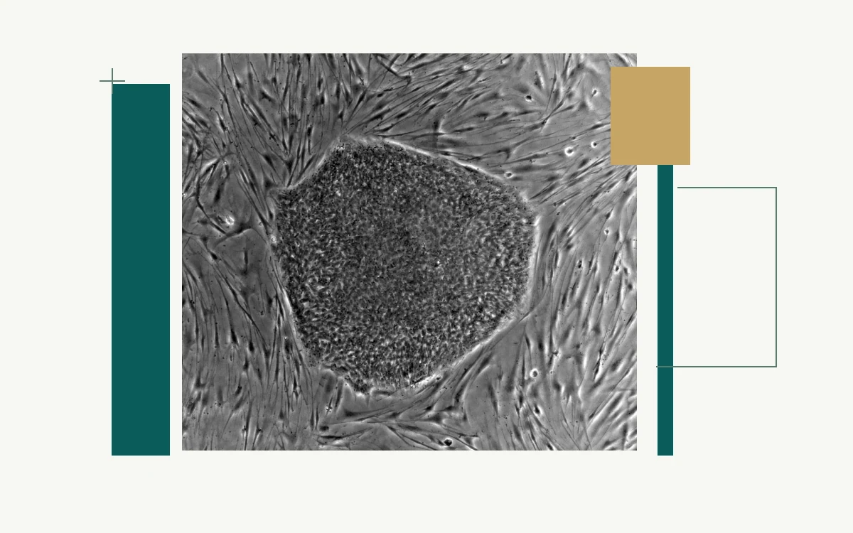 Microscopy of an embryonic stem-cell colony on feeder cells