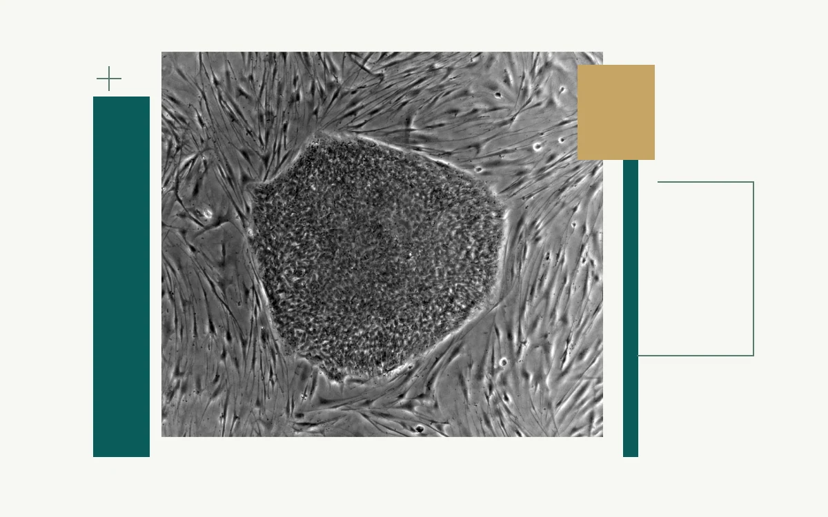 Microscopy of an embryonic stem-cell colony on feeder cells