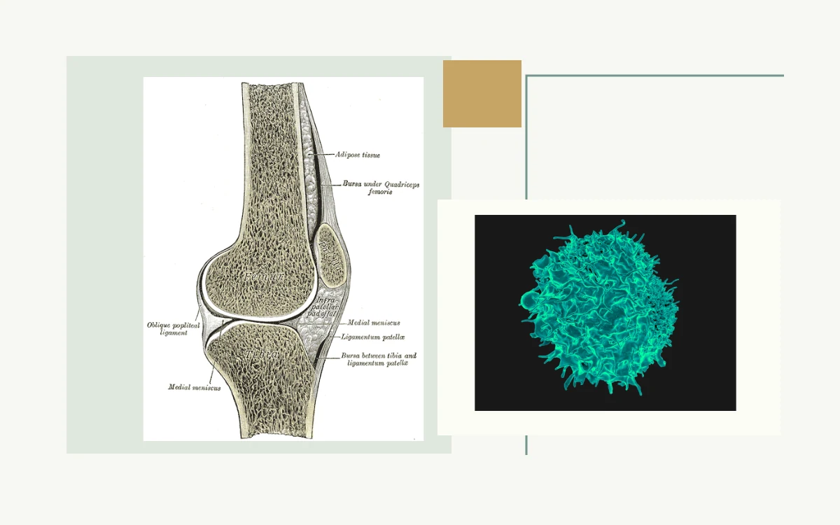 Historical anatomical illustration: cross-section of the right knee joint · Colourized electron micrograph of a T lymphocyte