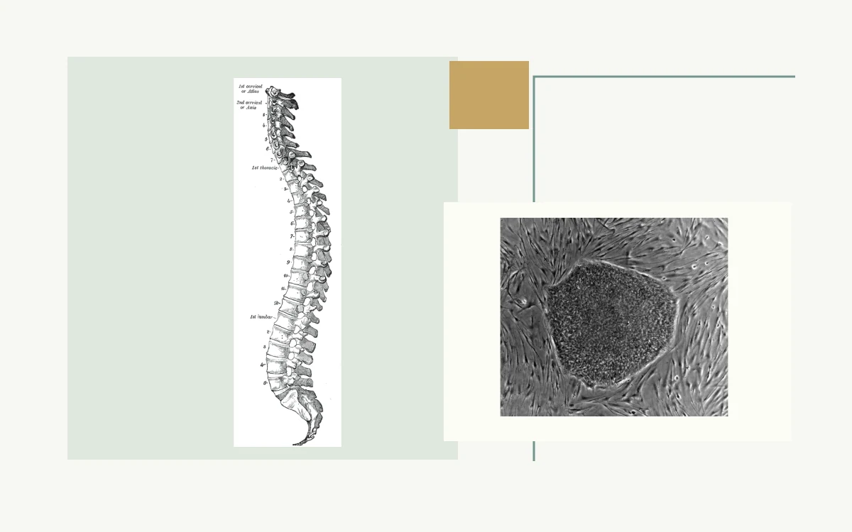 Historical anatomical illustration: side view of the spine · Microscopy of an embryonic stem-cell colony on feeder cells