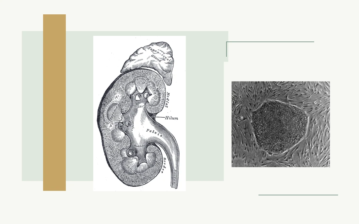 Historical anatomical illustration: lengthwise section of a kidney · Microscopy of an embryonic stem-cell colony on feeder cells